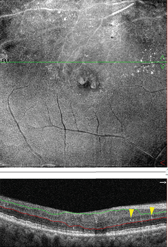 Details are in the caption following the image Details are in the caption following the image