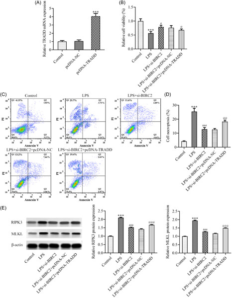Downregulation of BIRC2 hinders the progression of rheumatoid arthritis through regulating TRADD