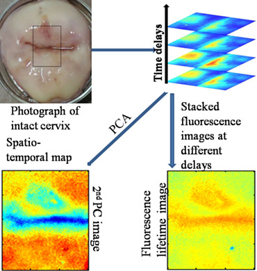 Spatio-temporal map for early cancer detection: Proof of concept