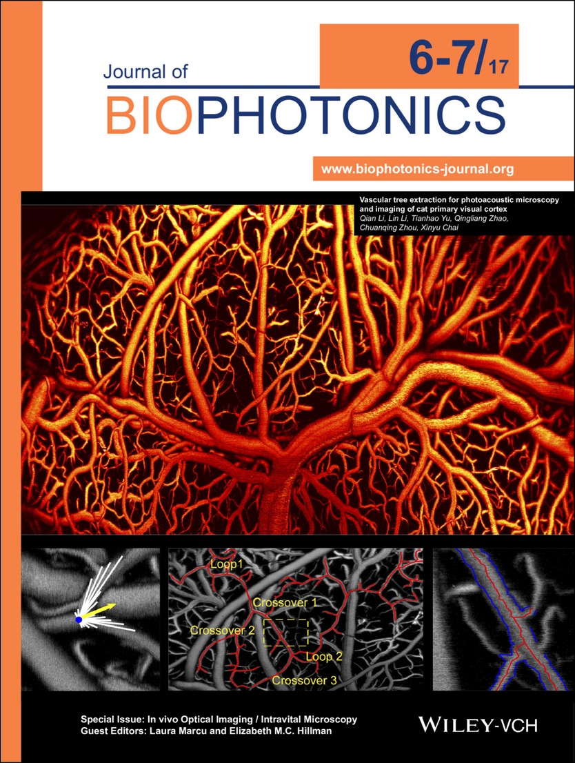 Front Cover: Vascular tree extraction for photoacoustic microscopy and imaging of cat primary visual cortex (J. Biophotonics 6-7/2017) Volume 10 Issue 6-7, 2017