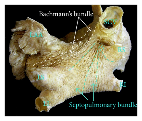 Details are in the caption following the image