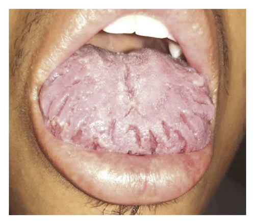 Details are in the caption following the image Details are in the caption following the image