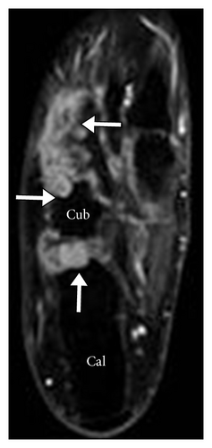 Details are in the caption following the image