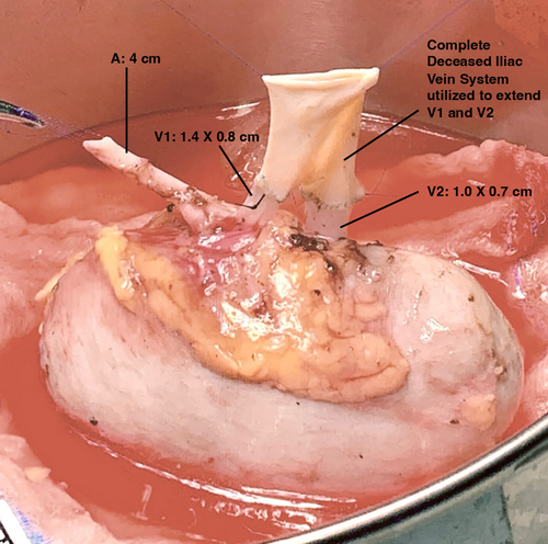 Details are in the caption following the image