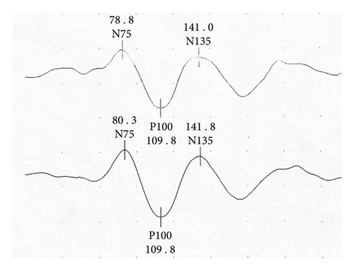 Details are in the caption following the image
