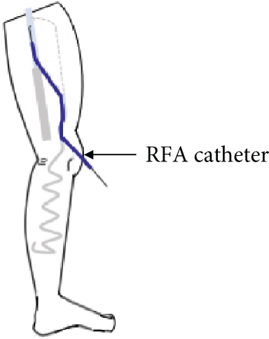 Details are in the caption following the image