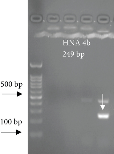 Details are in the caption following the image
