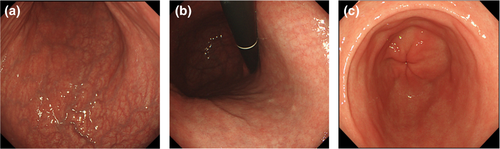 Details are in the caption following the image Details are in the caption following the image