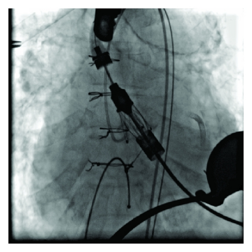 Details are in the caption following the image