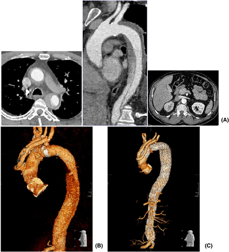 Details are in the caption following the image Details are in the caption following the image