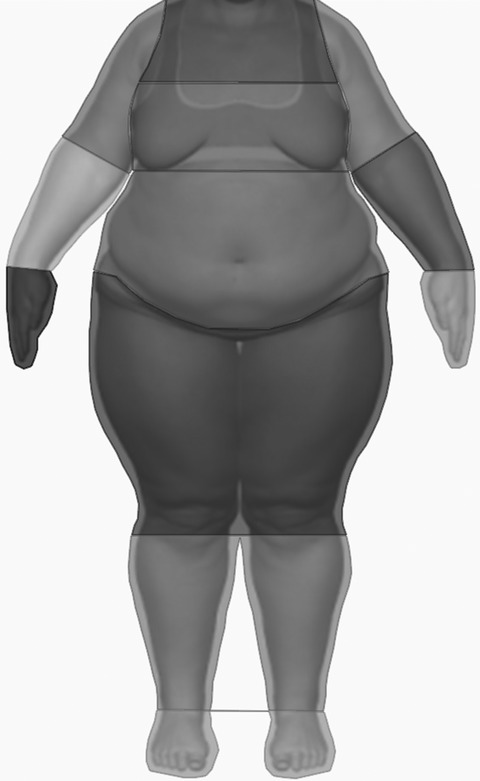 Faced with one’s fear: Attentional bias in anorexia nervosa and healthy individuals upon confrontation with an obese body stimulus in an eye-tracking paradigm