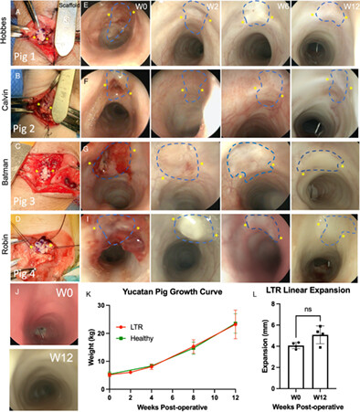 A Pilot Study of Decellularized Cartilage for Laryngotracheal Reconstruction in a Neonatal Pig Model