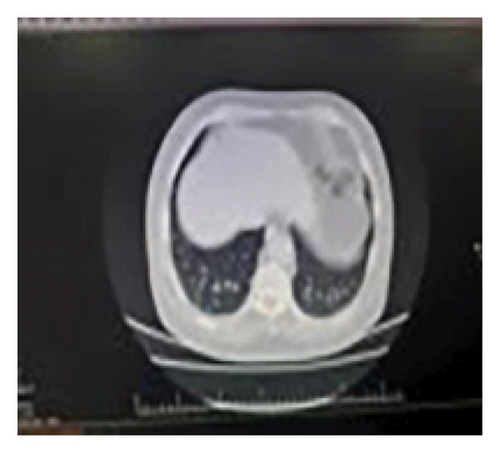 Details are in the caption following the image