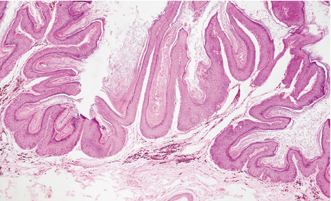 Carbon dioxide laser treatment of extensive pigmented viral plaque lesions in a golden retriever dog