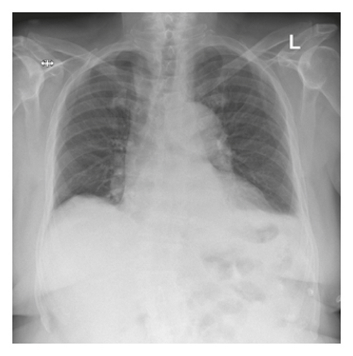 Details are in the caption following the image