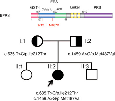 Aminoacylation-defective bi-allelic mutations in human EPRS1 associated with psychomotor developmental delay, epilepsy, and deafness