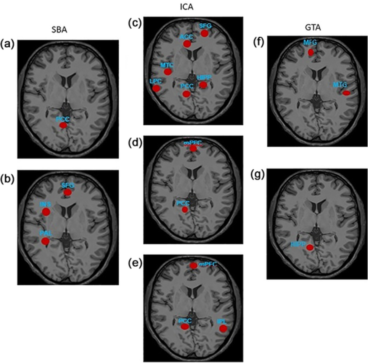 Diagnostic power of resting-state fMRI for detection of network connectivity in Alzheimer's disease and mild cognitive impairment: A systematic review