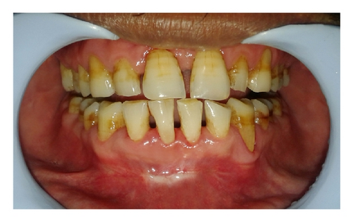 Details are in the caption following the image Details are in the caption following the image