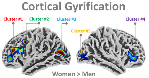 Cortical gyrification in women and men and the (missing) link to prenatal androgens
