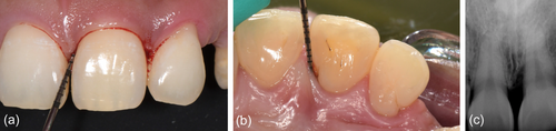 Details are in the caption following the image Details are in the caption following the image