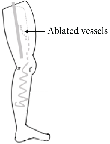 Details are in the caption following the image