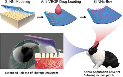 Long-Term Diabetic Retinopathy Treatment Using Silicon Nanoneedles