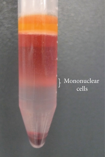 Details are in the caption following the image