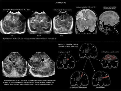 Details are in the caption following the image Details are in the caption following the image