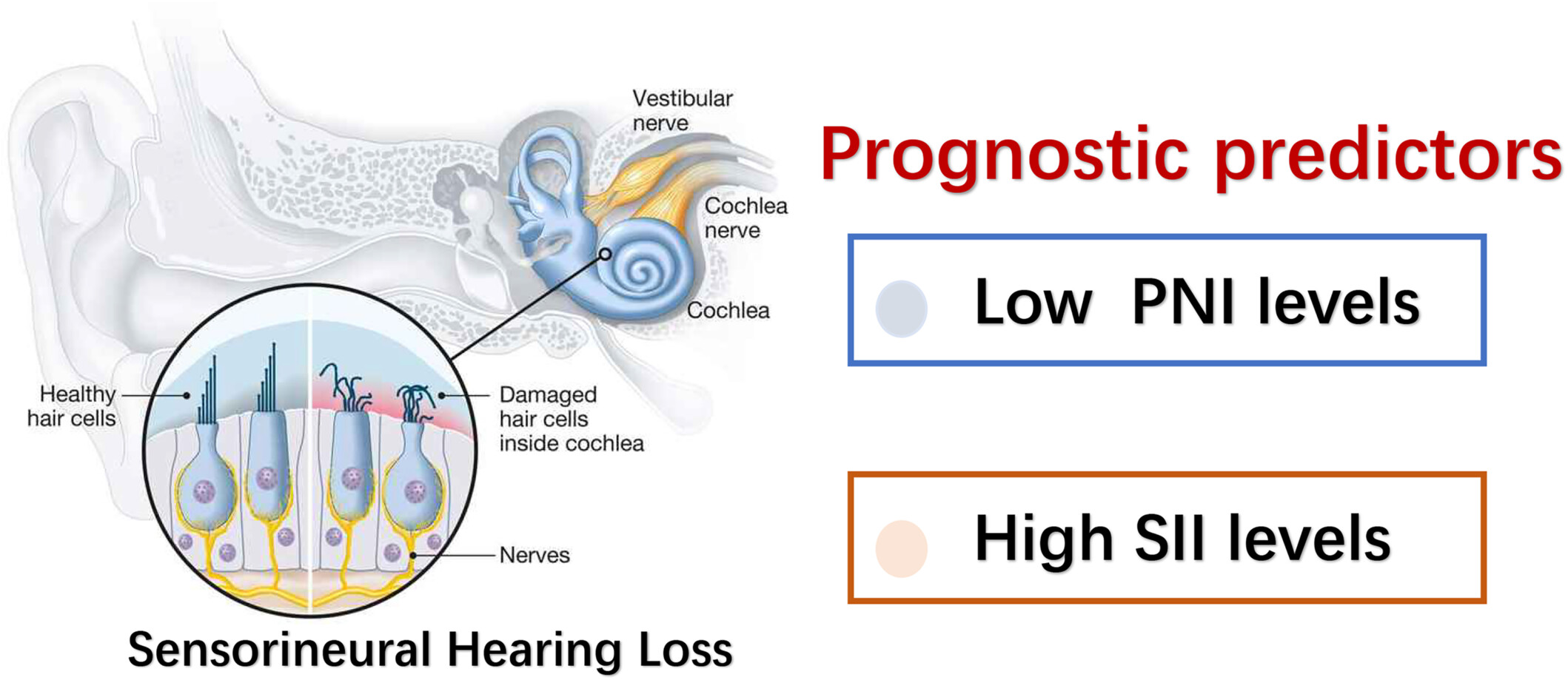 Utility of Prognostic Nutritional Index and Systemic Immune-Inflammation Index Inpatients With Sudden Sensorineural Hearing Loss: A Large Prospective Cohort Study
