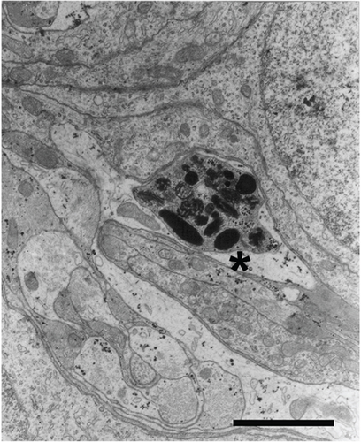 Details are in the caption following the image
