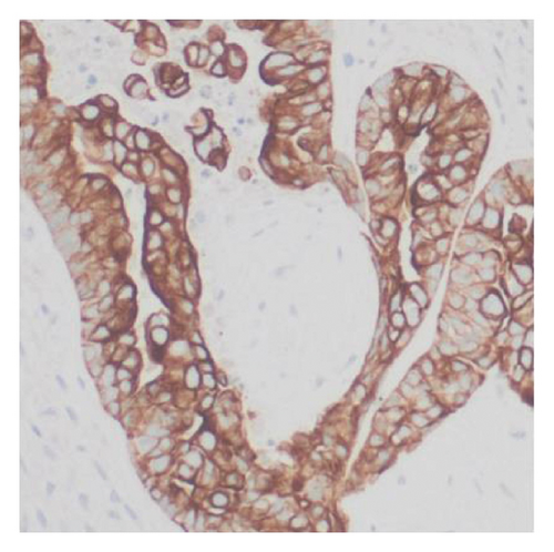 Details are in the caption following the image