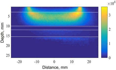 Assessment of the dynamics of human glymphatic system by near-infrared spectroscopy