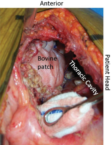 Details are in the caption following the image