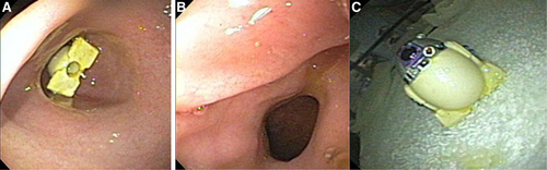 Details are in the caption following the image Details are in the caption following the image