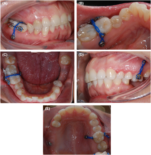Details are in the caption following the image Details are in the caption following the image