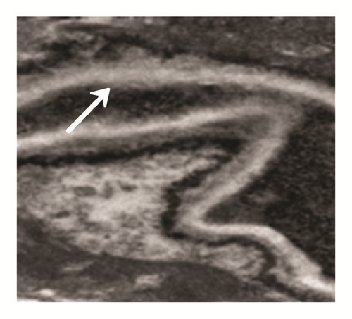 Details are in the caption following the image