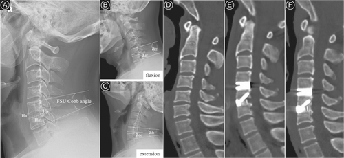 Details are in the caption following the image Details are in the caption following the image