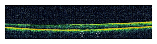 Details are in the caption following the image