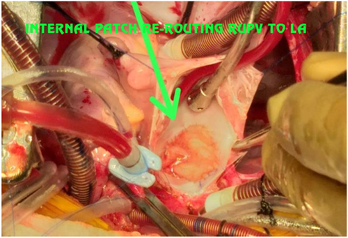 Details are in the caption following the image Details are in the caption following the image