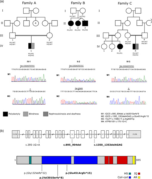 Novel IQCE variations confirm its role in postaxial polydactyly and cause ciliary defect phenotype in zebrafish