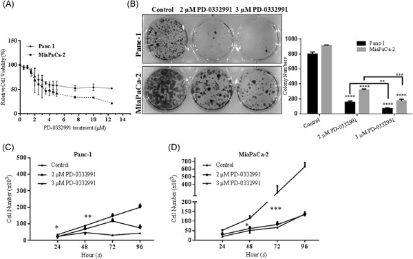 Palbociclib, a selective CDK4/6 inhibitor, restricts cell survival and epithelial-mesenchymal transition in Panc-1 and MiaPaCa-2 pancreatic cancer cells