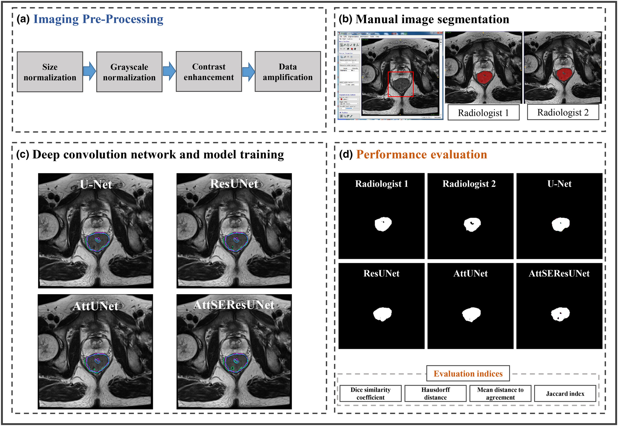 Improved deep learning for automatic localisation and segmentation of rectal cancer on T2-weighted MRI