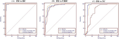 The clinical value of high fluorescent lymphocytes and smudge cells in the diagnosis of infectious mononucleosis