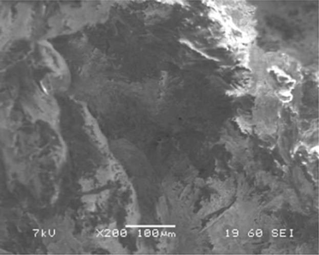 Separation and Preconcentration of Aluminum by Candida albicans Immobilized on Cellulose Acetate Biomass