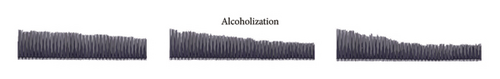 Details are in the caption following the image