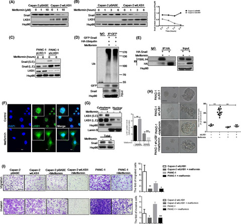 LKB1 obliterates Snail stability and inhibits pancreatic cancer metastasis in response to metformin treatment