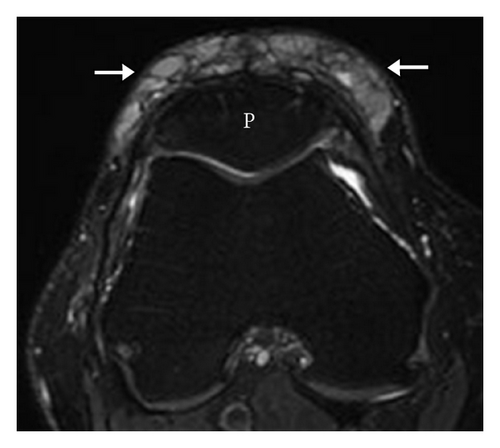 Details are in the caption following the image