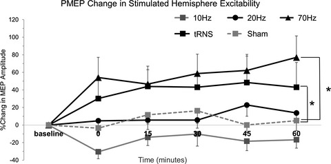 Exploring parameters of gamma transcranial alternating current stimulation (tACS) and full-spectrum transcranial random noise stimulation (tRNS) on human pharyngeal cortical excitability