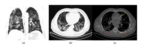 Details are in the caption following the image Details are in the caption following the image