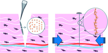 Organ Repair, Hemostasis, and In Vivo Bonding of Medical Devices by Aqueous Solutions of Nanoparticles